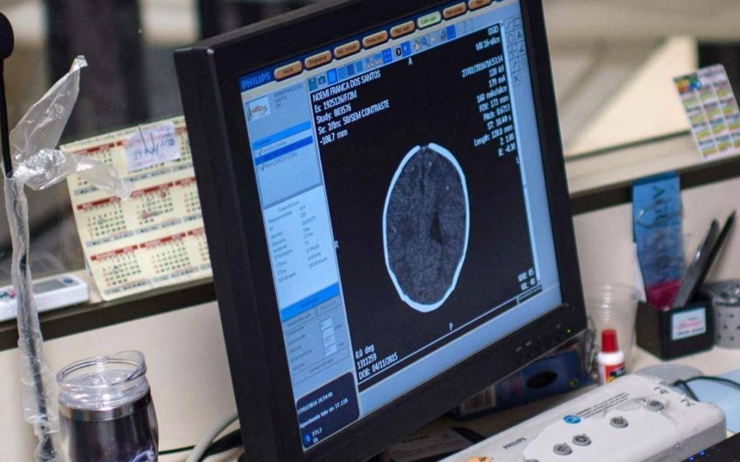 Salute, Padovani (Sin): “Longevità aumenta rischio Alzheimer, agire su prevenzione”