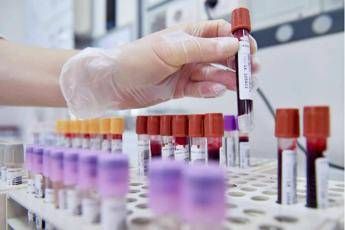 Tumore allo stomaco in stadio precoce, con immunoterapia 69% pazienti vivo a 3 anni