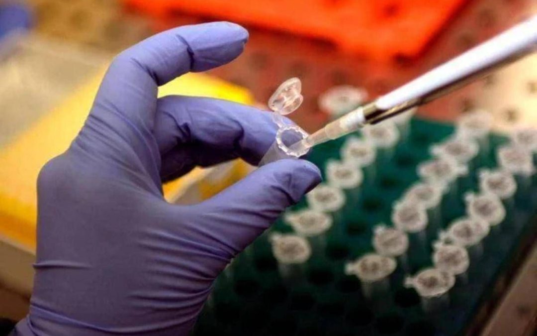 Cancro alla prostata, Dna potrebbe svelare rischio basso o alto: lo studio