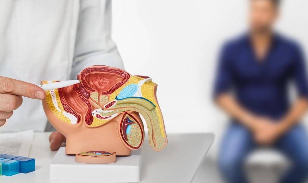 Cancro alla prostata, terapia con radioligandi riduce avanzamento malattia