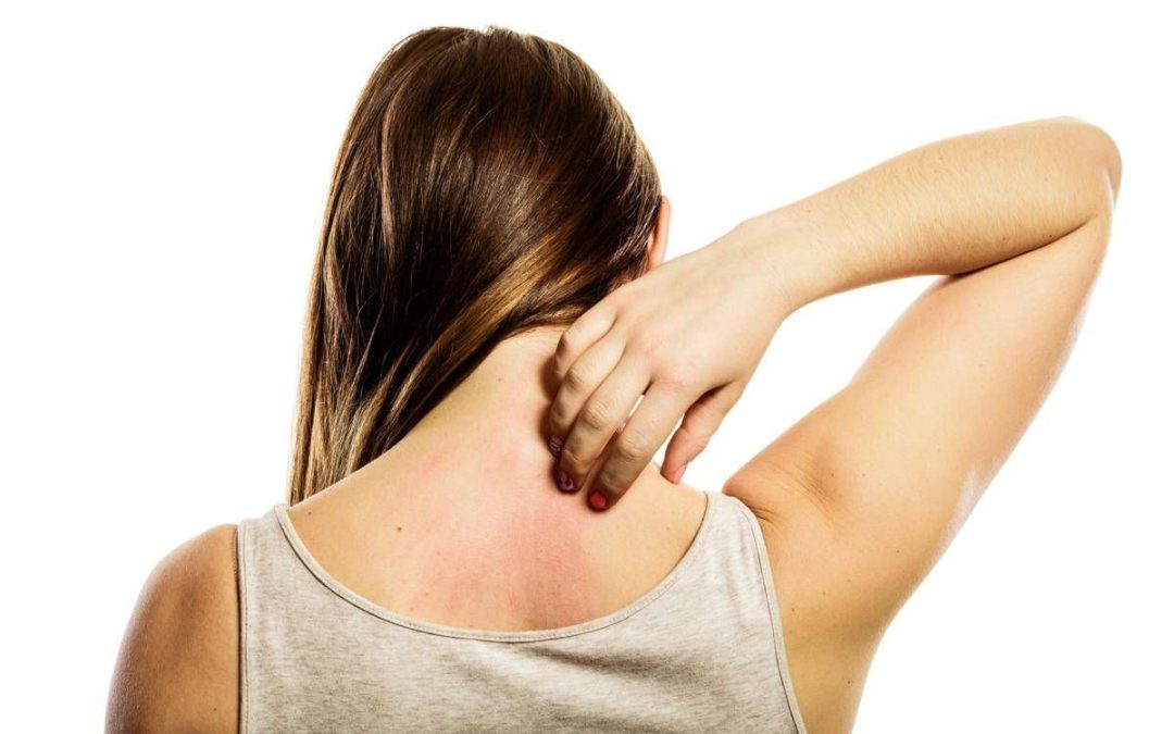 Dermatite atopica, raccolta firme per inserirla in Piano cronicità e Lea