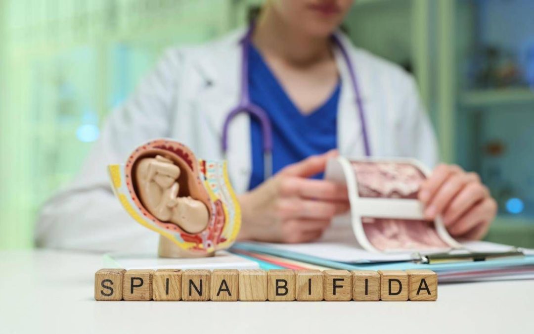 Giornata spina bifida, da prevenzione a nuove tecniche chirurgiche