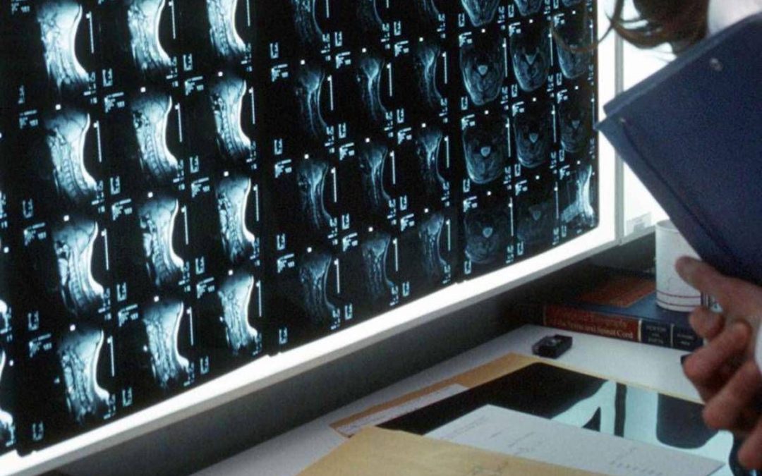 Oltre 500 malattie rare delle ossa, esperti: “Investire in prevenzione e diagnosi”