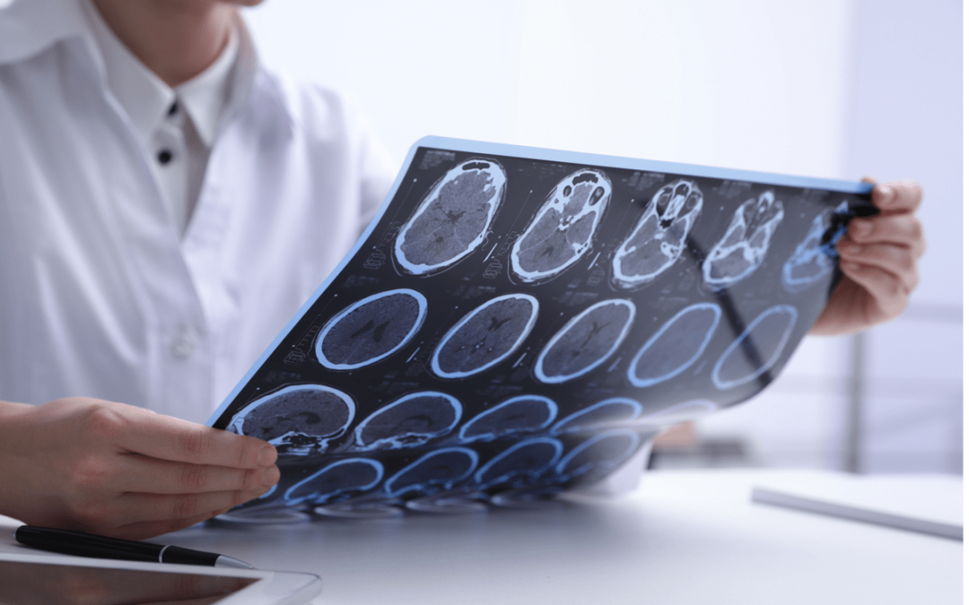 Salute, psicologa Borghi: “Oltre la sclerosi multipla un percorso verso il futuro”