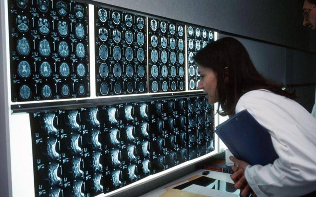 Cancro, 4 sintomi ‘insoliti’ che bisogna conoscere: parola di oncologo