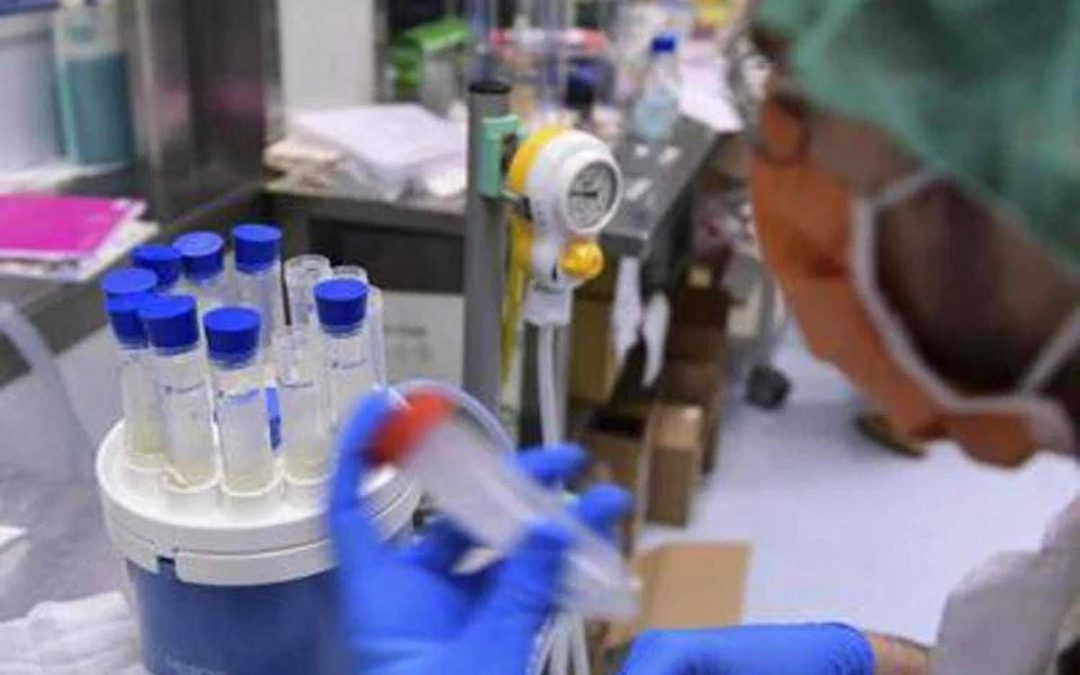 Focolaio di legionella a Milano, una casa positiva: ora si controlla l’acquedotto