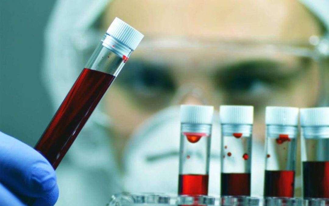 Leucemia linfatica cronica, con zanubrutinib sopravvivenza al 74% a 6 anni