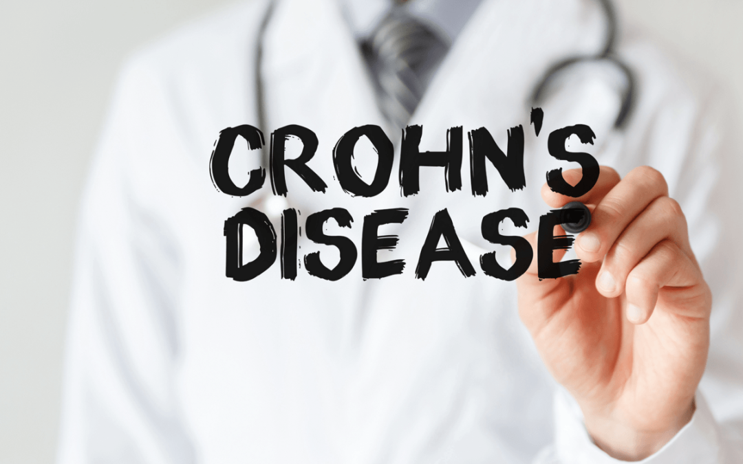 Medicina: malattia di Crohn, nutrizione clinica in corsi regionali Ig-Ibd per gastroenterologi