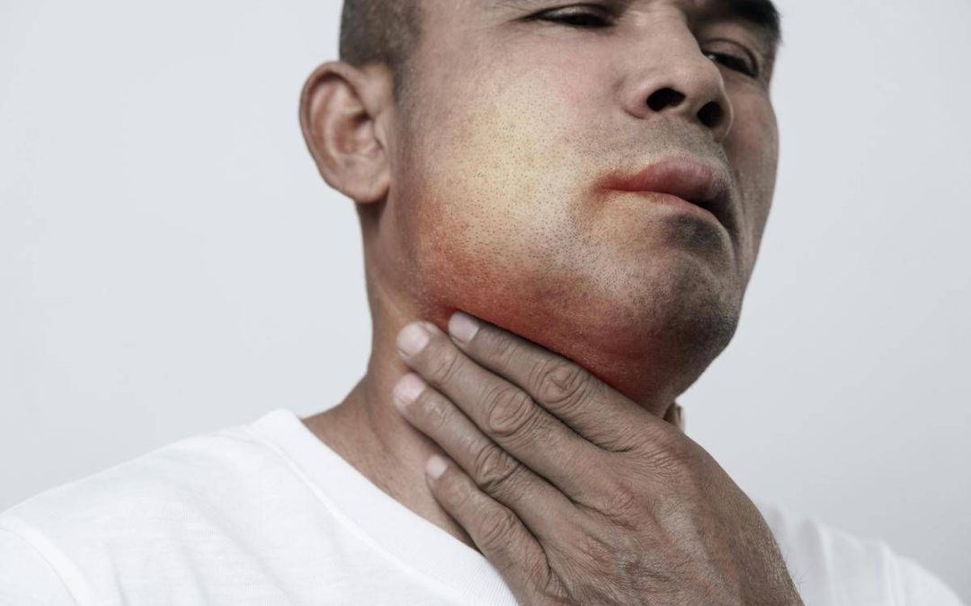 Angioedema ereditario, ok Ue a prima terapia preventiva mirata all’Rna
