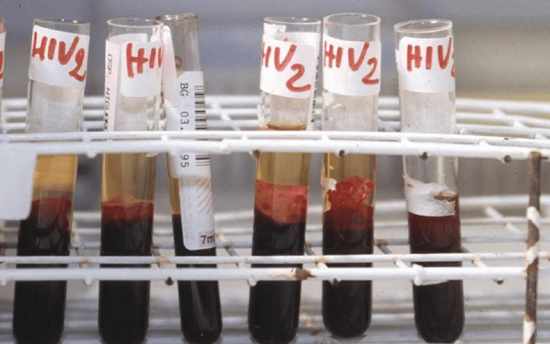 Hiv, oggi a Bari incontro su terapie long acting e prevenzione