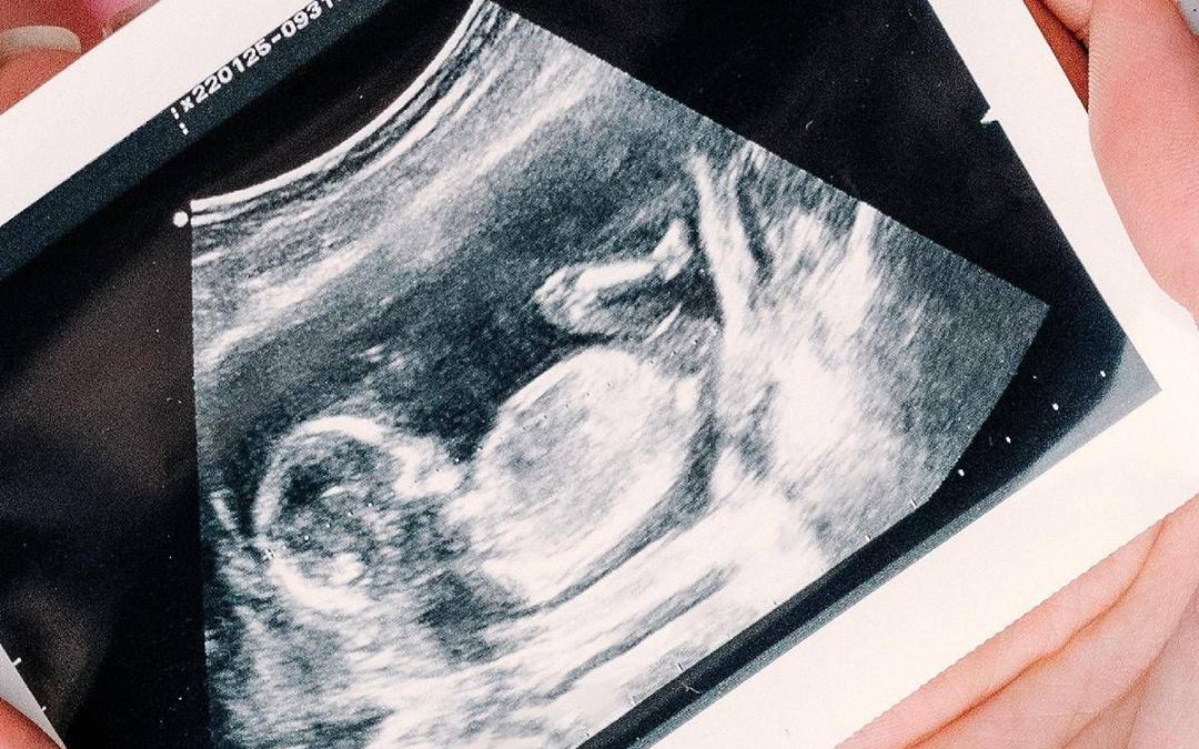 Gravidanza, arrivano le nuove linee guida dell’Iss: ecco quando fare e quando non fare l’ecografia e altri esami