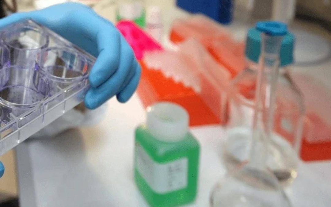 Colite ulcerosa, nuovi dati dallo studio Verdict su vedolizumab