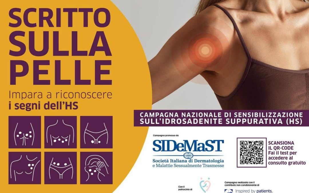 Idrosadenite suppurativa, al via campagna di sensibilizzazione ‘Scritto sulla pelle’