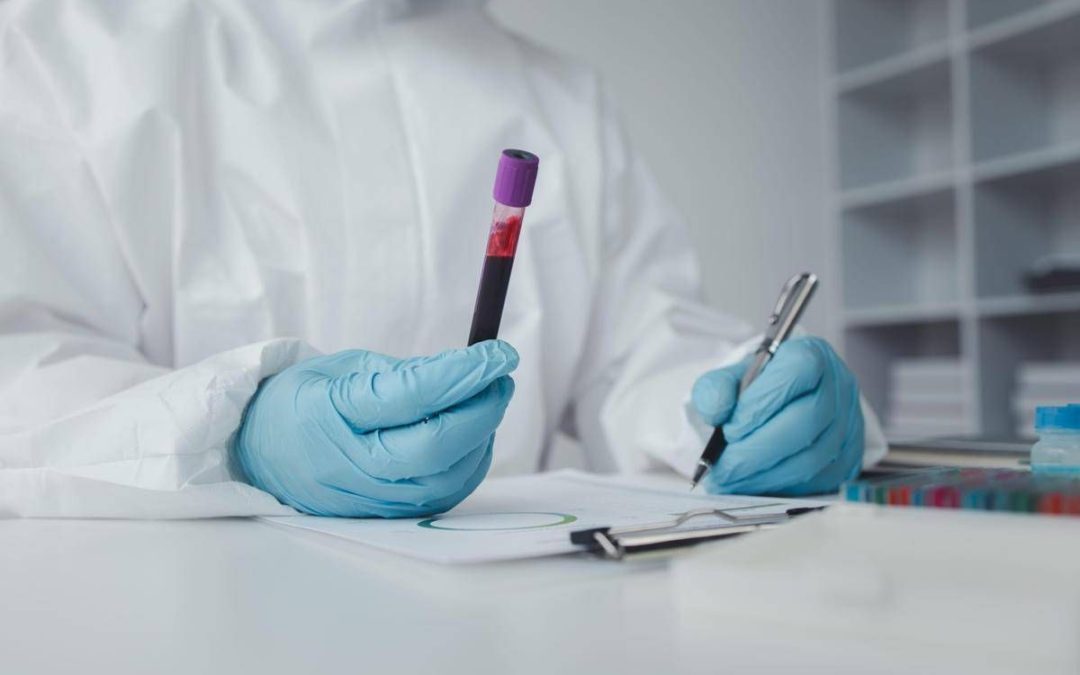 In Francia primo caso umano di virus Shamonda, il paziente è morto: alert Ecdc